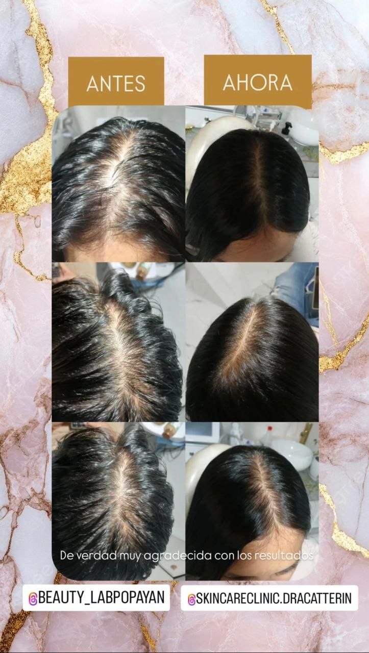 Resultado real BeautyLab 4